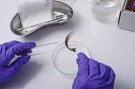 HAIR FOLLICLE TEST